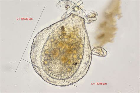  Arcella! Een Microscopische Wonderwereld van een Cel, Bedekken met een Verrassende Huls en Constante Beweging